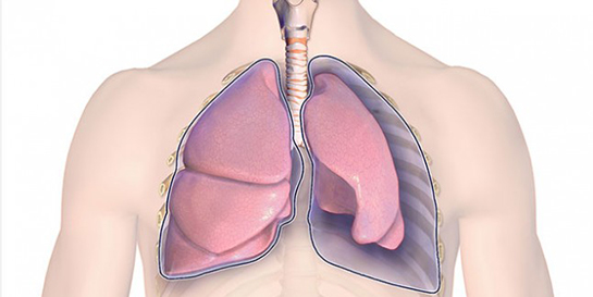 Akciğer Kanseri Su Toplaması