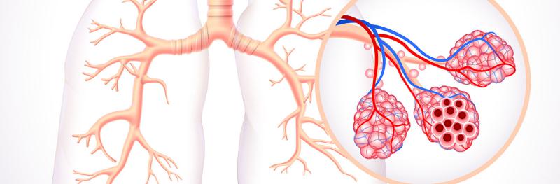 Ciğerlerin Su Toplaması Öldürücü Olabilir mi?